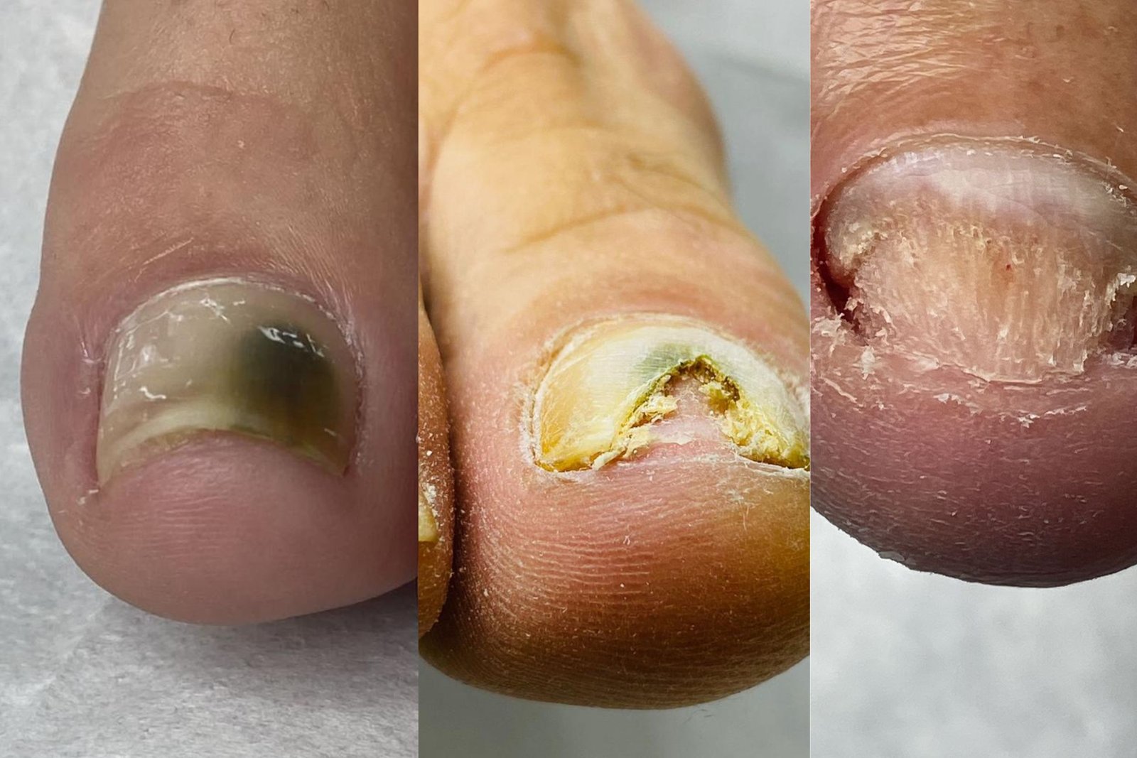 Podóloga em Itajaí