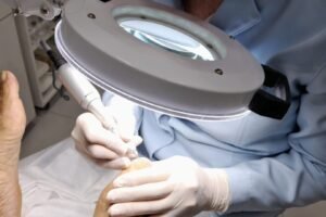 Podólogo realizando tratamento de unha encravada com equipamento de precisão sob lupa iluminada.